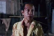 ជនរងគ្រោះ